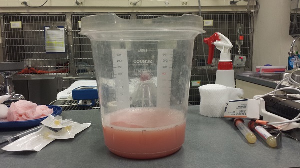 Thursday, 4/23/2015 - This is the fluid that was taken from Ronnie James' chest cavity. It's 300 ml (a cup and a quarter), and it's not even all that was in there. The doctor didn't want to try to drain all of it, because it would have been too risky. The fluid is chyle (chyle can either be cloudy or pink).